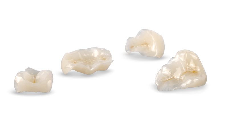 Composite Restoration