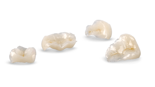 Composite Restoration